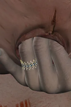 A Big Problem 2 (65)