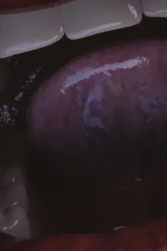 The Babysitter (187)