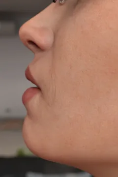 FTF Transfromation (23)