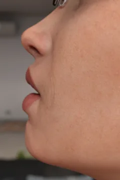 FTF Transfromation (24)