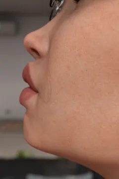 FTF Transfromation (25)